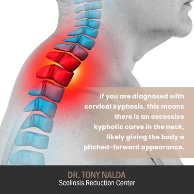 Cervical Kyphosis What Is The Best Treatment For Kyphosis