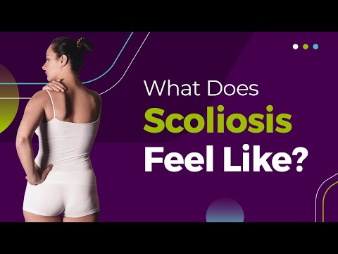 why you may think you have a short leg : r/scoliosis
