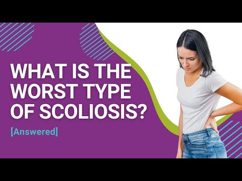 What is the Worst Type of Scoliosis? [Answered]