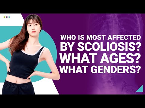 Who Is Most Affected By Scoliosis? What Ages? What Genders?