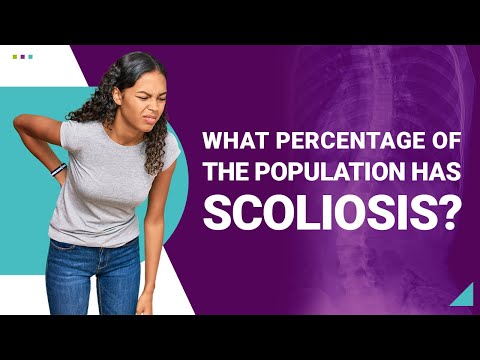 What Percentage of the Population Has Scoliosis?