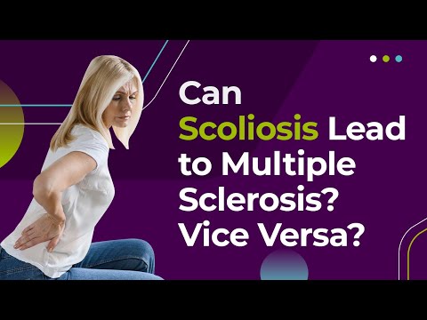 Can Scoliosis Lead to Multiple Sclerosis? Vice Versa?
