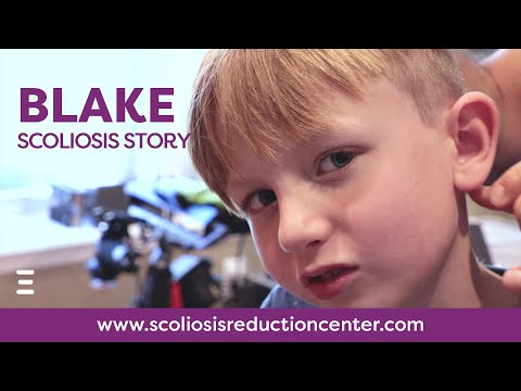 Child Scoliosis Treatment Without Surgery, Blake&#039;s Story