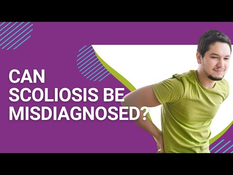 Can Scoliosis Be Misdiagnosed?