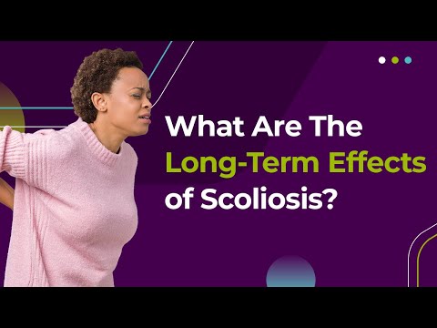 What Are The Long-Term Effects of Scoliosis?