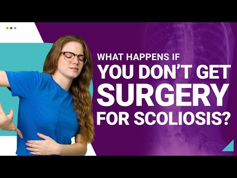 What Happens If You Don’t Get Surgery For Scoliosis?