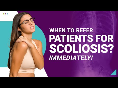 When to Refer Patients for Scoliosis? Immediately!