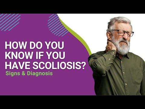 How Do You Know if You Have Scoliosis? Signs &amp; Diagnosis