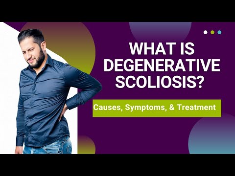 What is Degenerative Scoliosis? Causes, Symptoms, &amp; Treatment