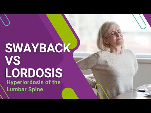 Swayback vs Lordosis: Hyperlordosis of the Lumbar Spine