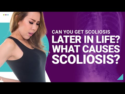 Can You Get Scoliosis Later in Life? What Causes Scoliosis?