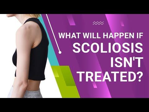 What Will Happen if Scoliosis Isn&#039;t Treated?