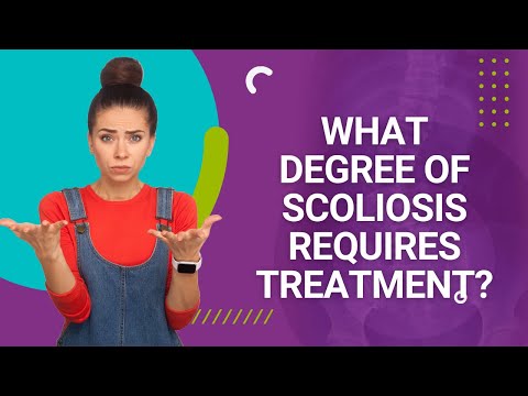 What Degree of Scoliosis Requires Treatment?
