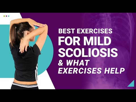 Best Exercises for Mild Scoliosis &amp; What Exercises Help