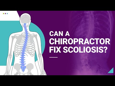 Can Chiropractic Help, Fix, or Cure Scoliosis? - Scoliosis Care Centers