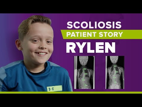 Adoloscent Scoliosis Progression &amp; Treatment Success: Rylen&#039;s Story