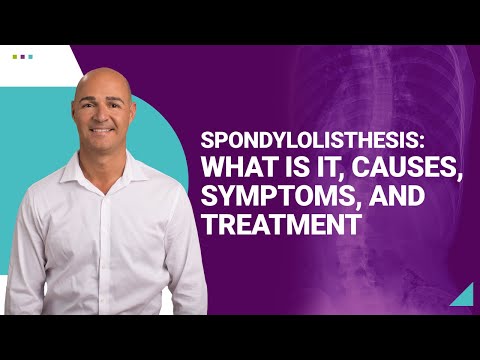 Spondylolisthesis: What is it, Causes, Symptoms, and Treatment