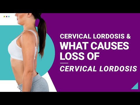 What Is Straightening of the Cervical Lordosis? - Regenexx