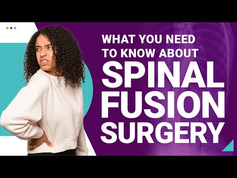 What You Need to Know About Spinal Fusion Surgery