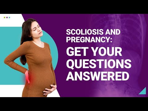 Scoliosis and Pregnancy: Get Your Questions Answered