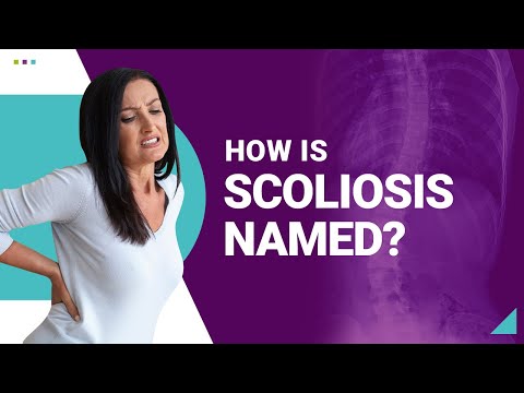 How is Scoliosis Named?
