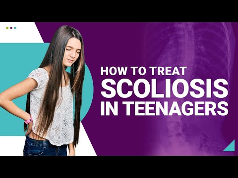 How To Treat Scoliosis In Teenagers?