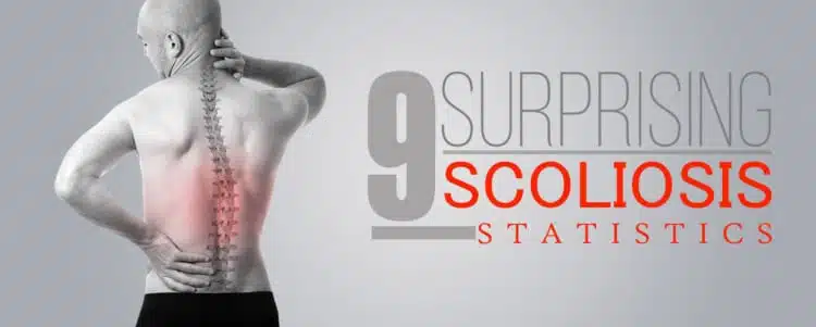 9 surprising scoliosis stats