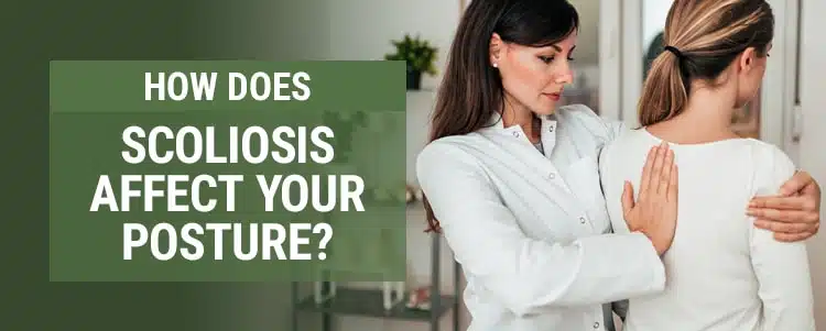 how does scoliosis affect your posture