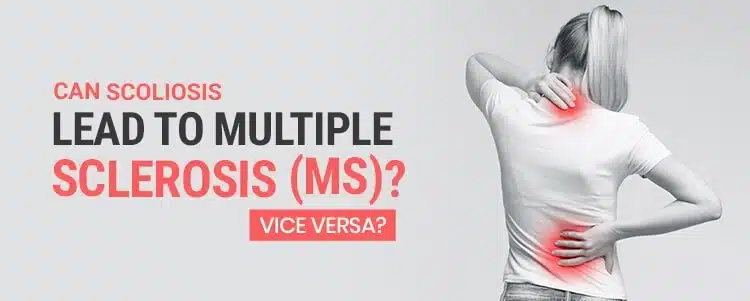 can scoliosis lead to multiple sclerosis