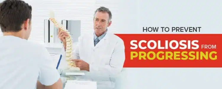 how to prevent scoliosis from progressing