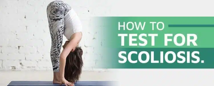 how to test for scoliosis