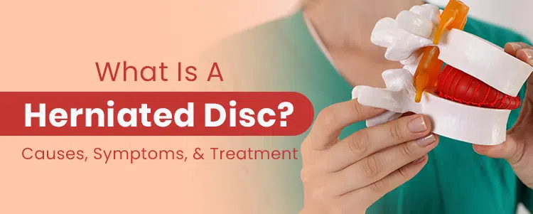 Slipped disc: what is it, symptoms and treatment