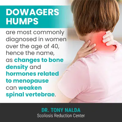 Dowager's Hump Is Not Just An 'Old' Problem