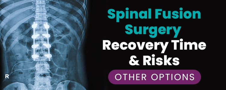 Spinal Fusion Surgery Recovery Time And Risks Other Options
