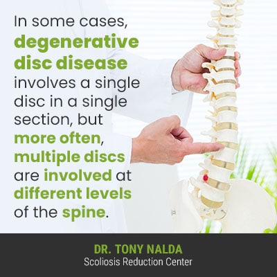 Can Long-Term Poor Posture Lead to Degenerative Spine Changes