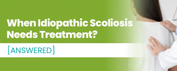 When Idiopathic Scoliosis Needs Treatment