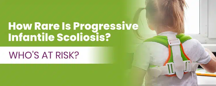 how rare is progressive infantile scoliosis