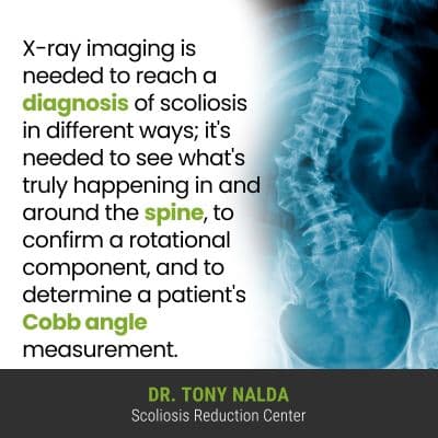 x ray imaging is 400