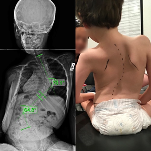 neuromuscular