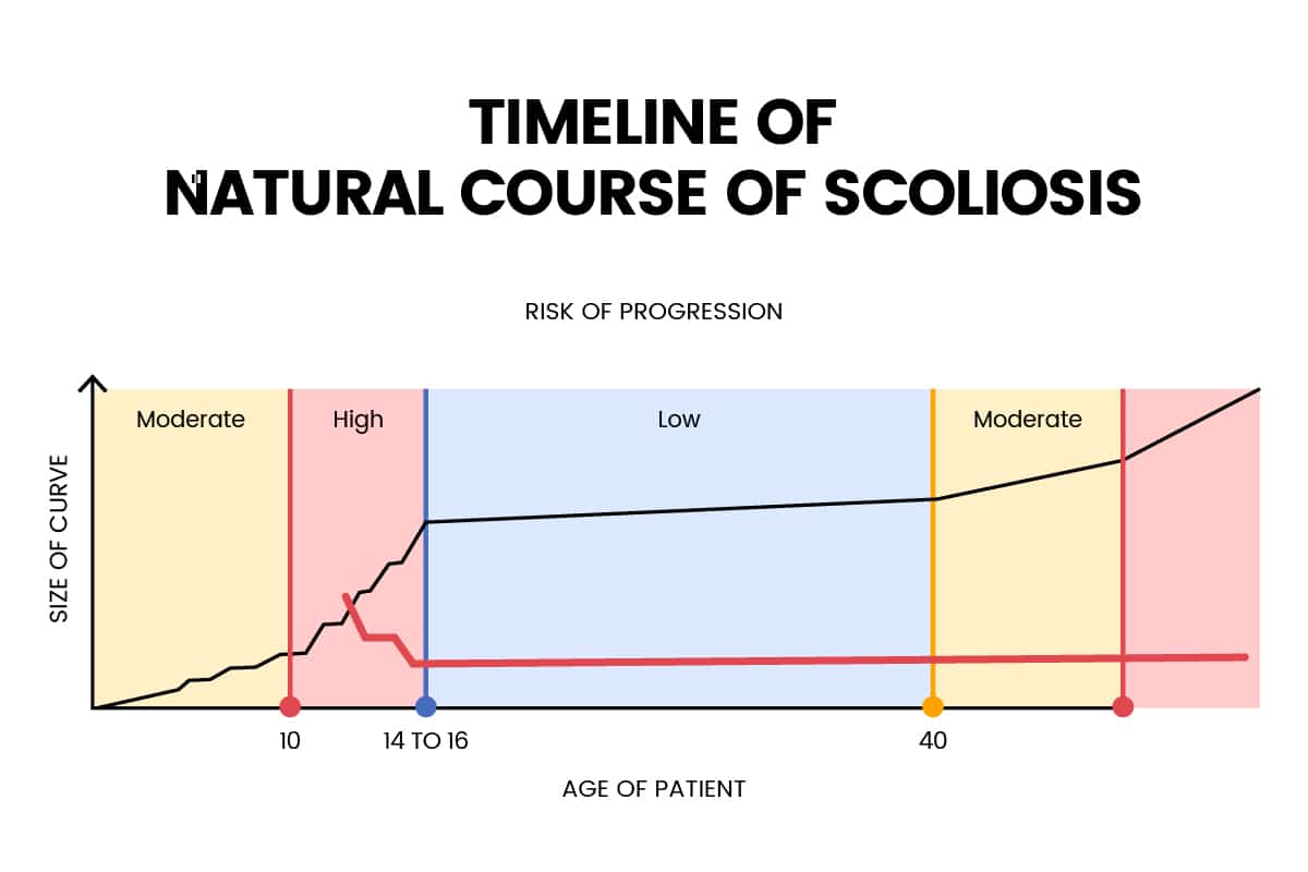 Alternate Progression Model for Adolescents