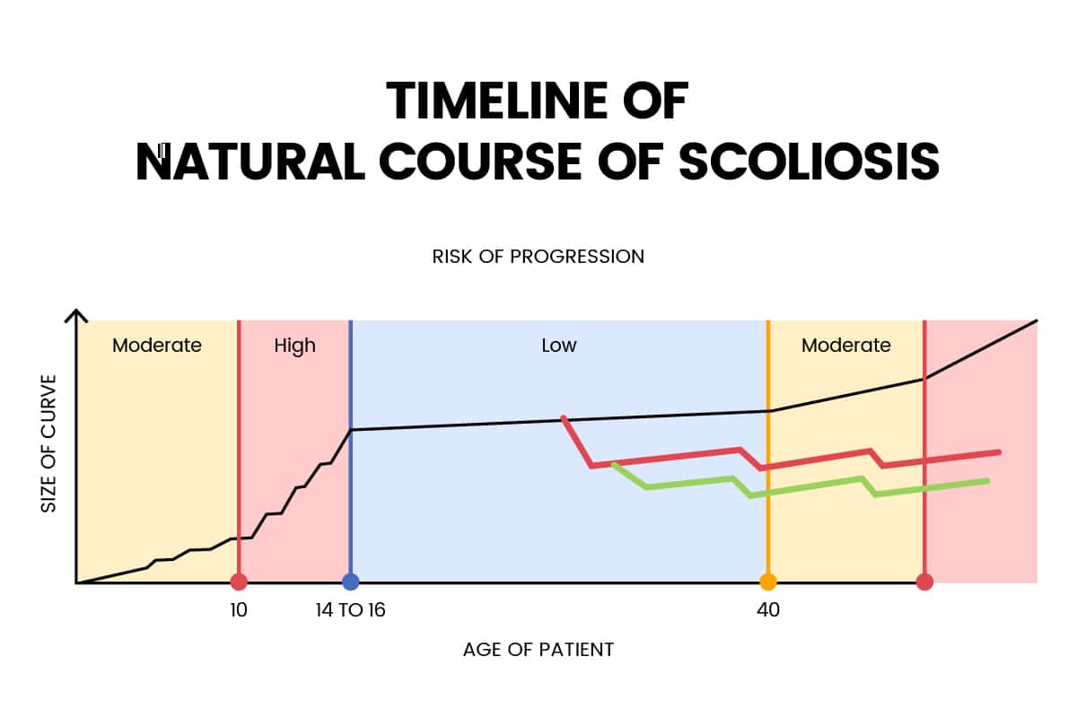 Alternate Progression Model for Adults with Adolescent Scoliosis