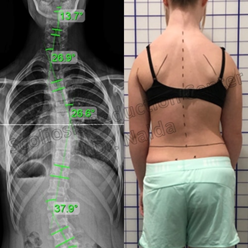 adolescent congenital