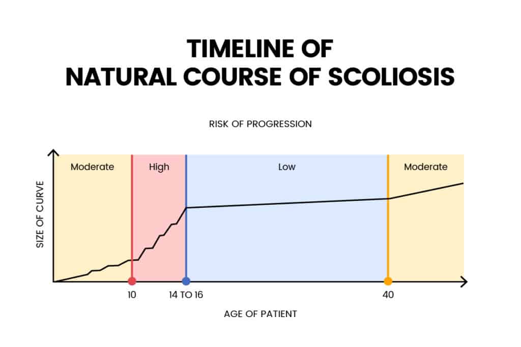 timeline of natural course of scoliosis